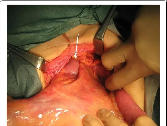 hdpic4-4